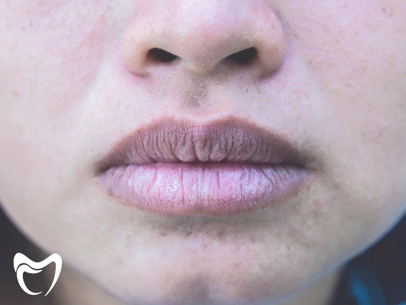 دلایل مهم خشکی دهان