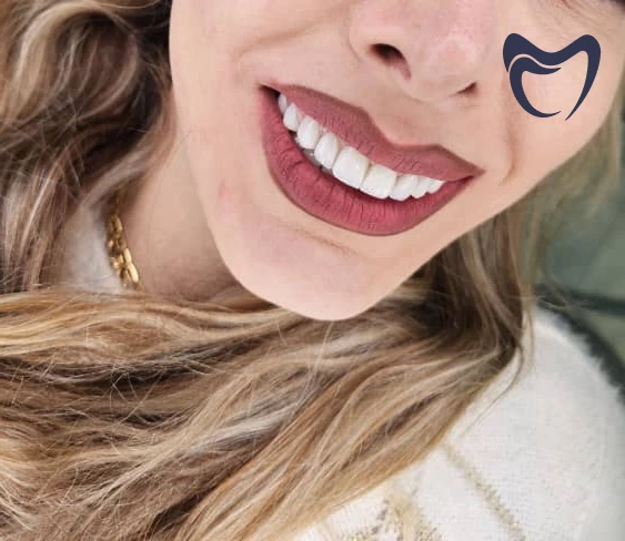 لمینت دندان