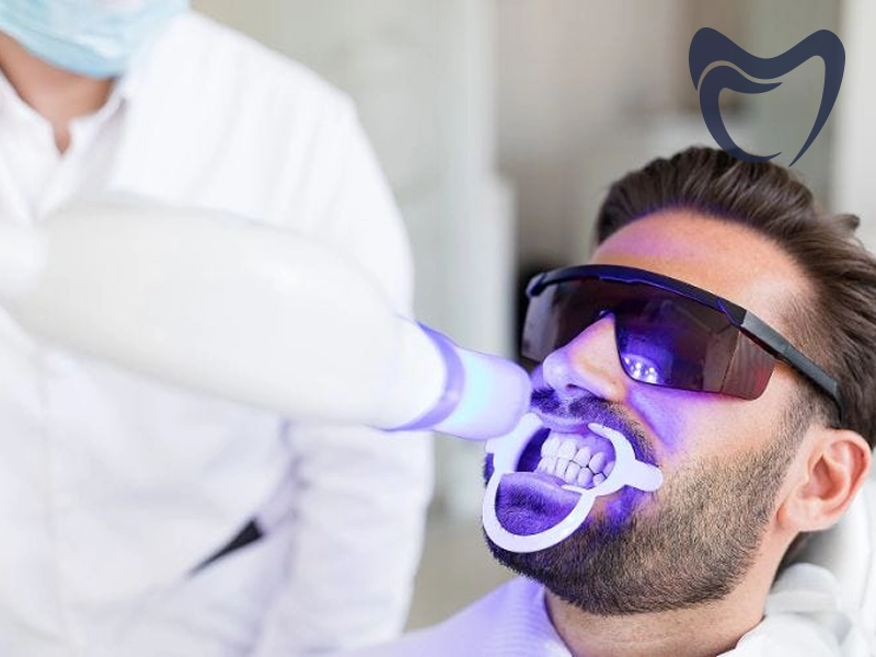 دوام بلیچینگ دندان چقدر است؟