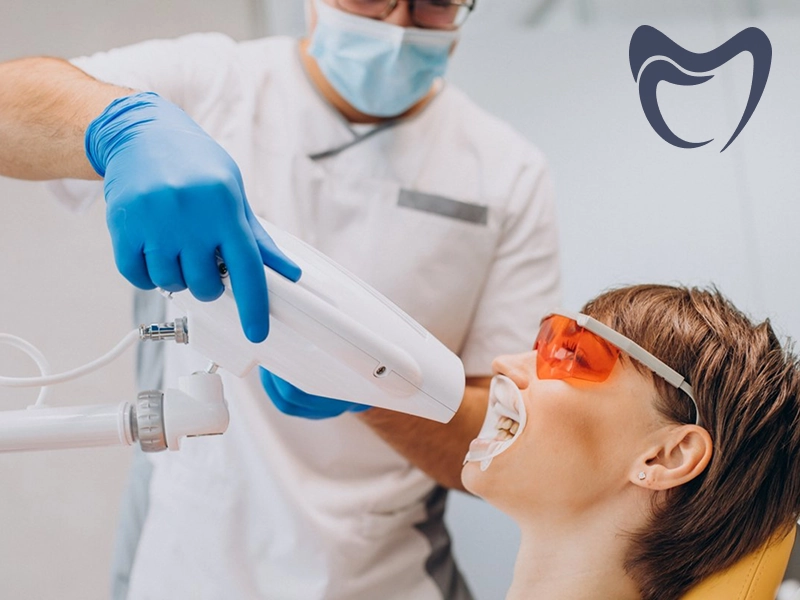 انواع بلیچینگ دندان